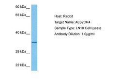 ALS2CR4 Rabbit anti-Human, Polyclonal, Novus Biologicals 0.1ml; Unconjugated:Antibodies,